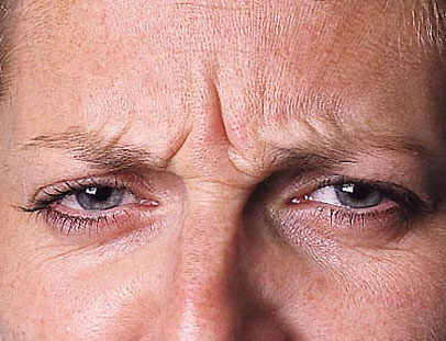 A photo of a person receiving Forehead treatment.