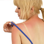 sund damage treatment