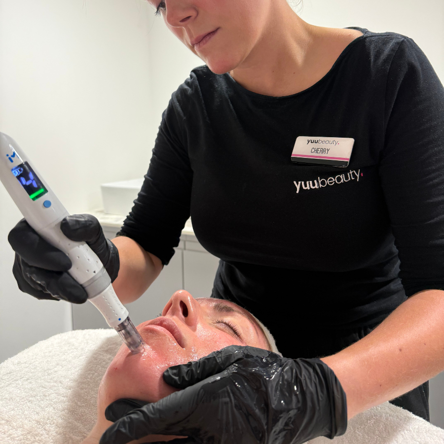 Microneedling Edinburgh | Dermapen Face & Neck Treatment