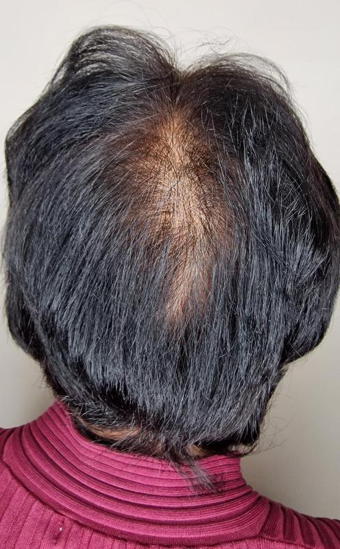 After Image
