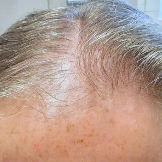 Before Image