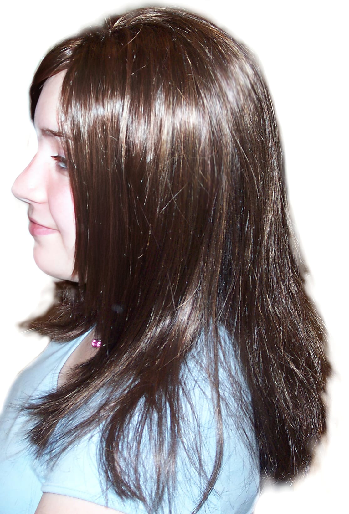 After Picture - Trichotillomania Success Story