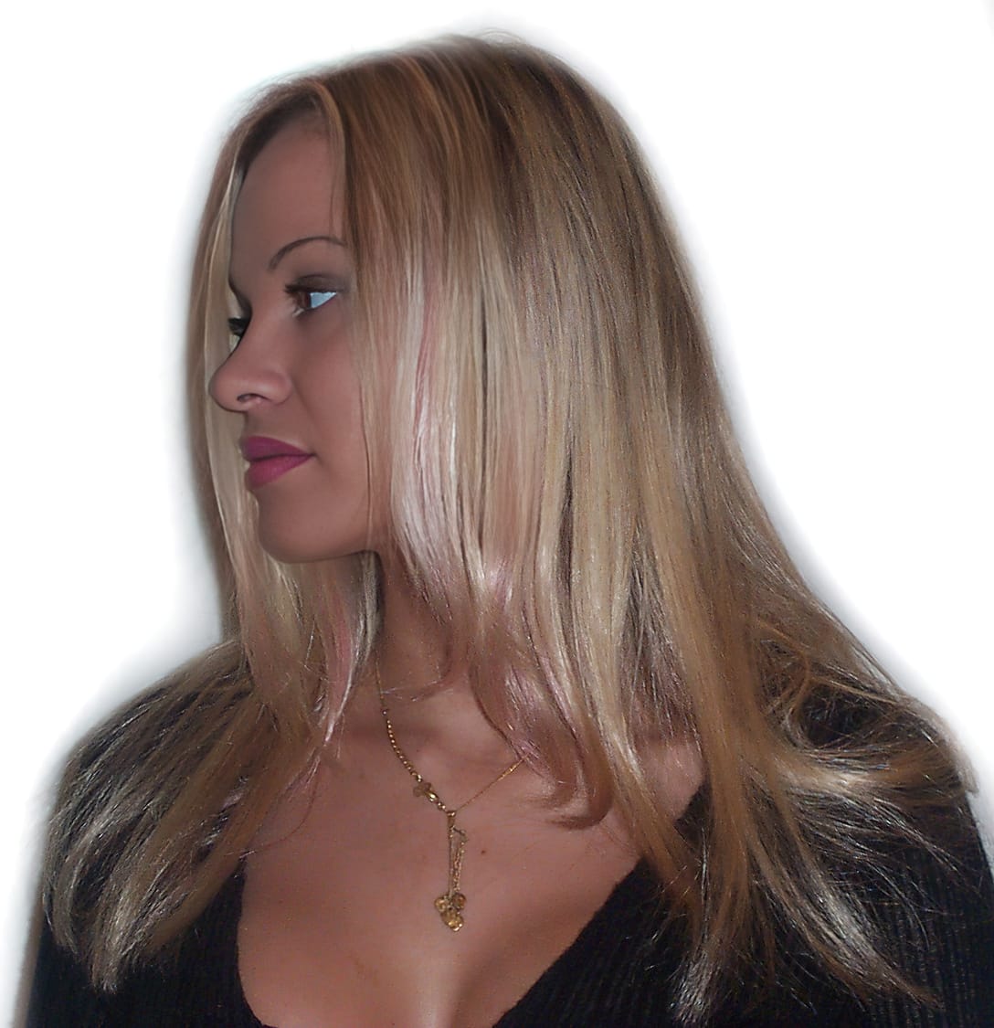After Picture - Real Hair Extensions Bald Patches Recovery