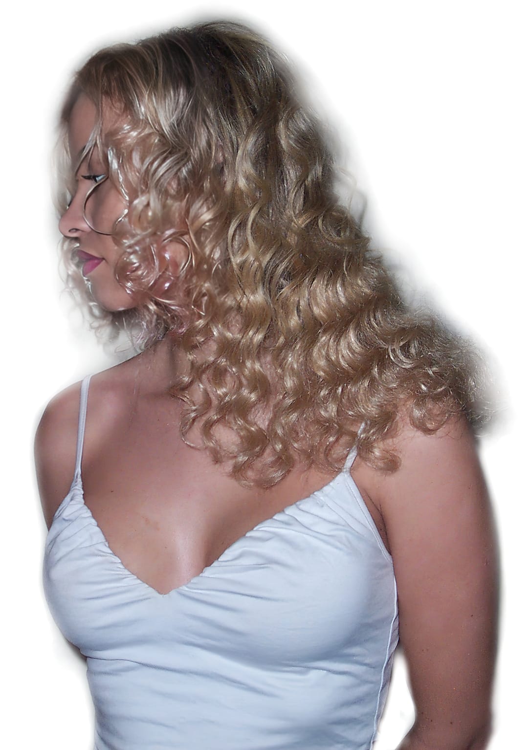 After Picture - Real Hair Extensions Bald Patches Recovery
