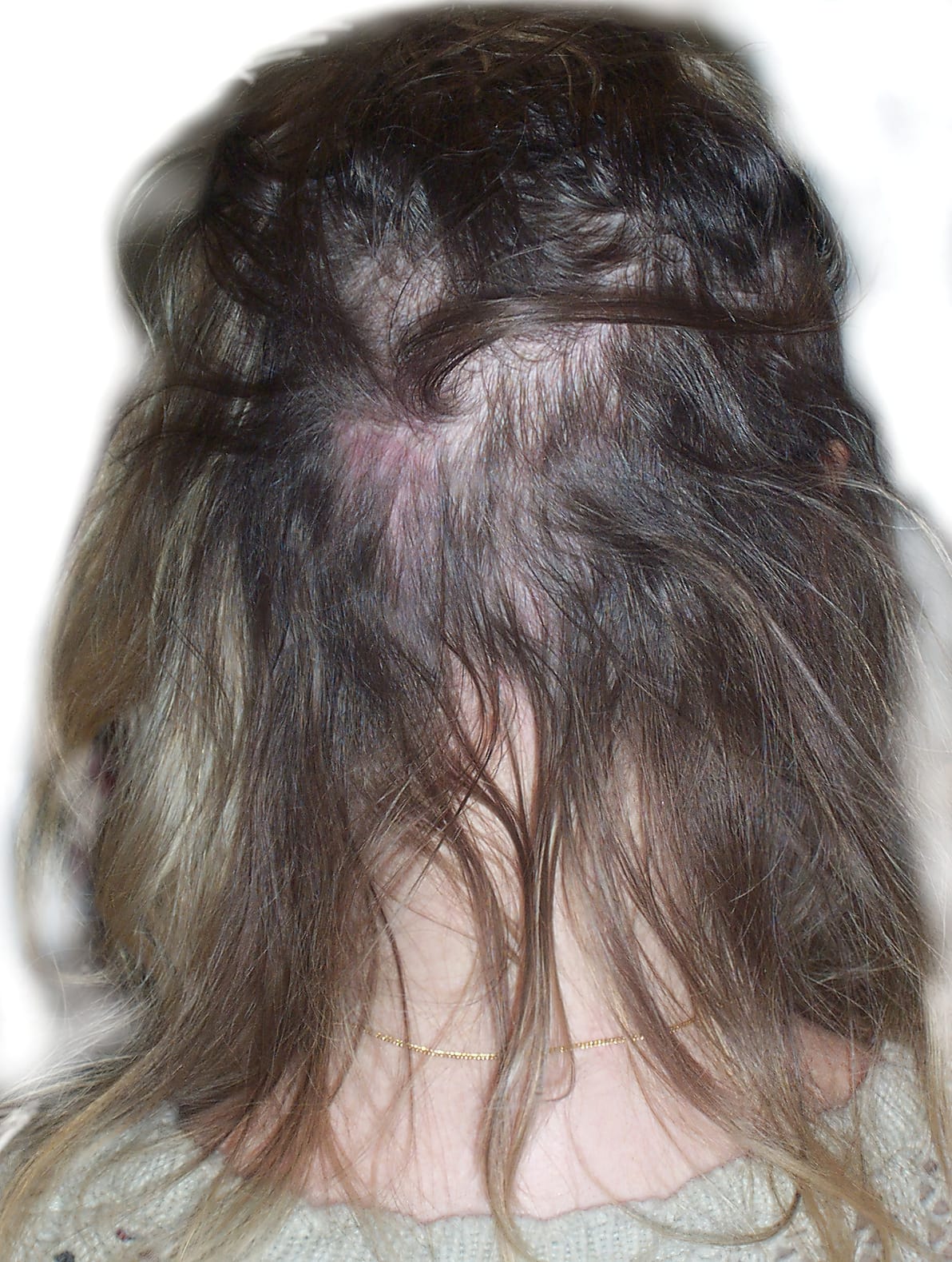 Before