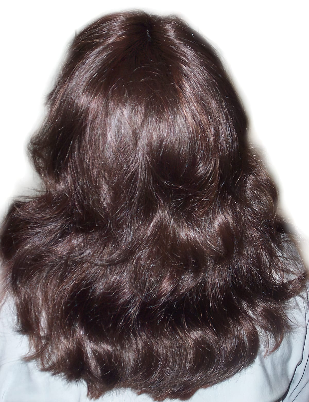 After Picture - Trichotillomania Cosmetic Fix