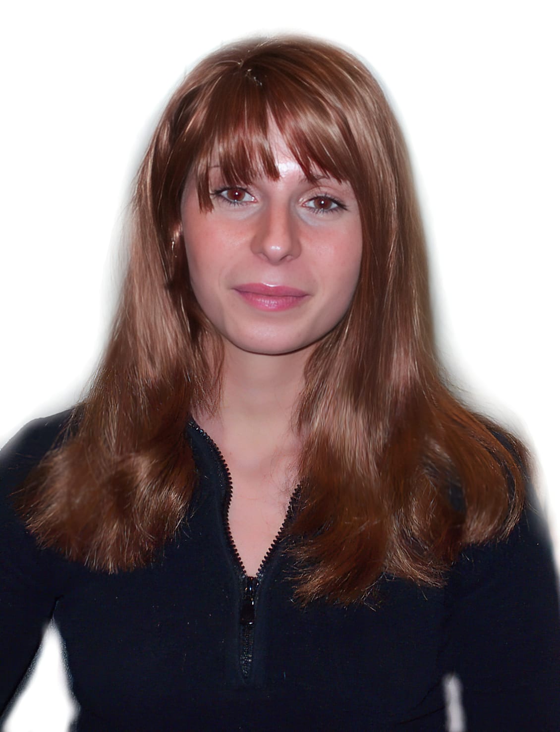 After Picture - Androgenetic Alopecia Cosmetic Cover-Up