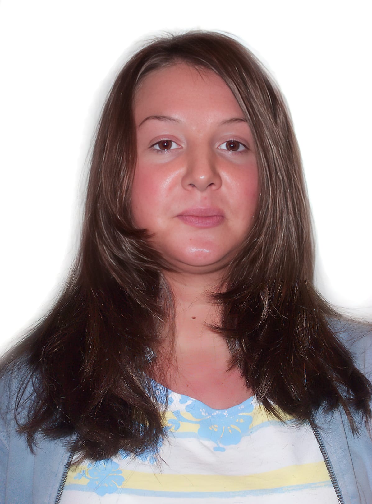 After Picture - Trichotillomania
