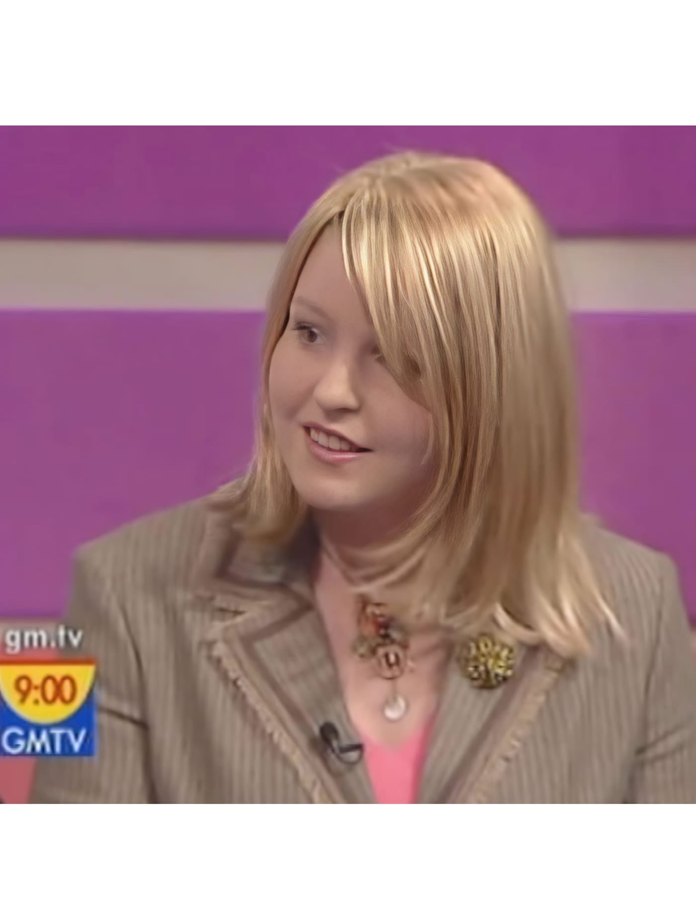 After Picture - Endometriosis Hair Loss Miracle Makeover - TV