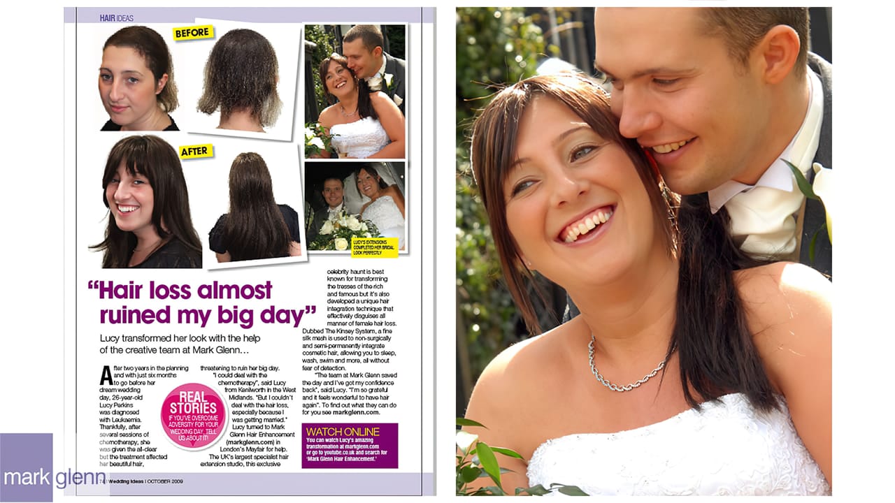 Leukaemia Hair Loss Restored for Wedding