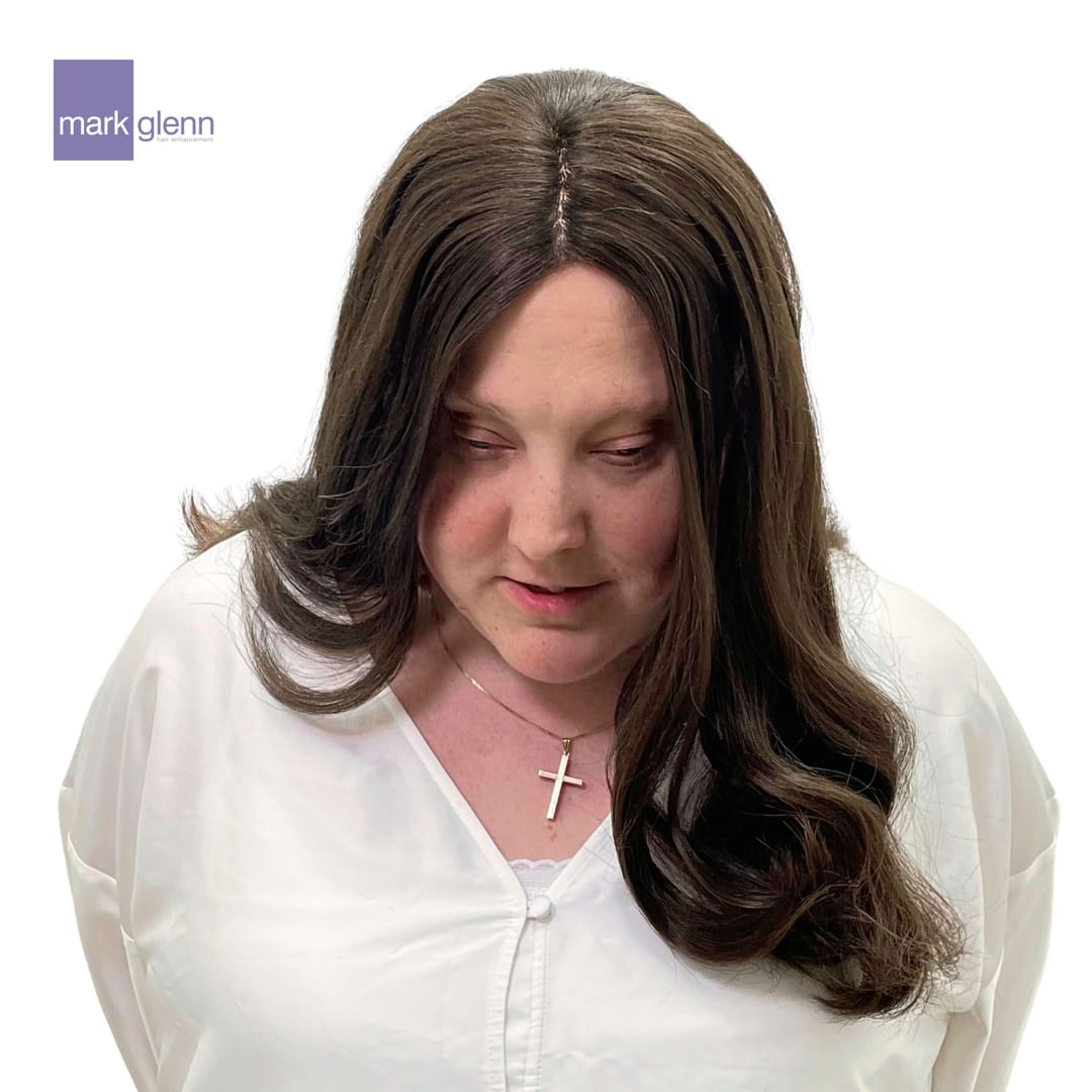 After Picture - Alopecia Areata Miracle Makeover