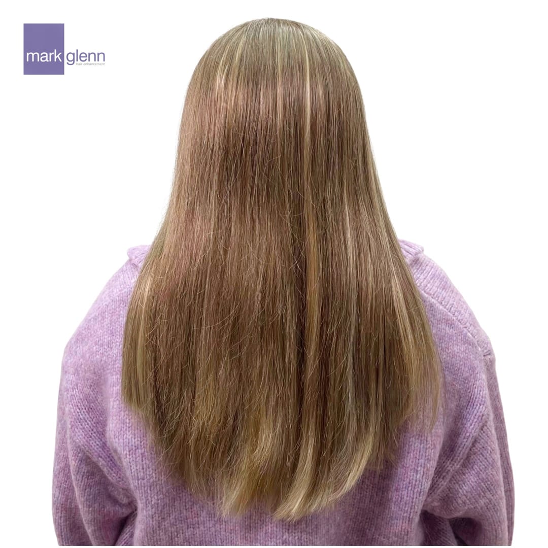 After Picture - Effectively Tackling Trichotillomania with The Kinsey System