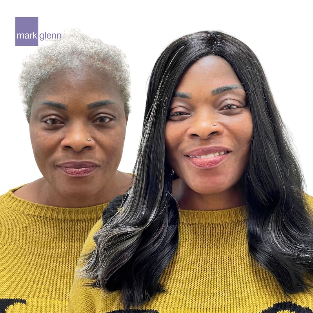 Afro Hair Loss Recovery - Semi-Permanent Alternative To Wigs