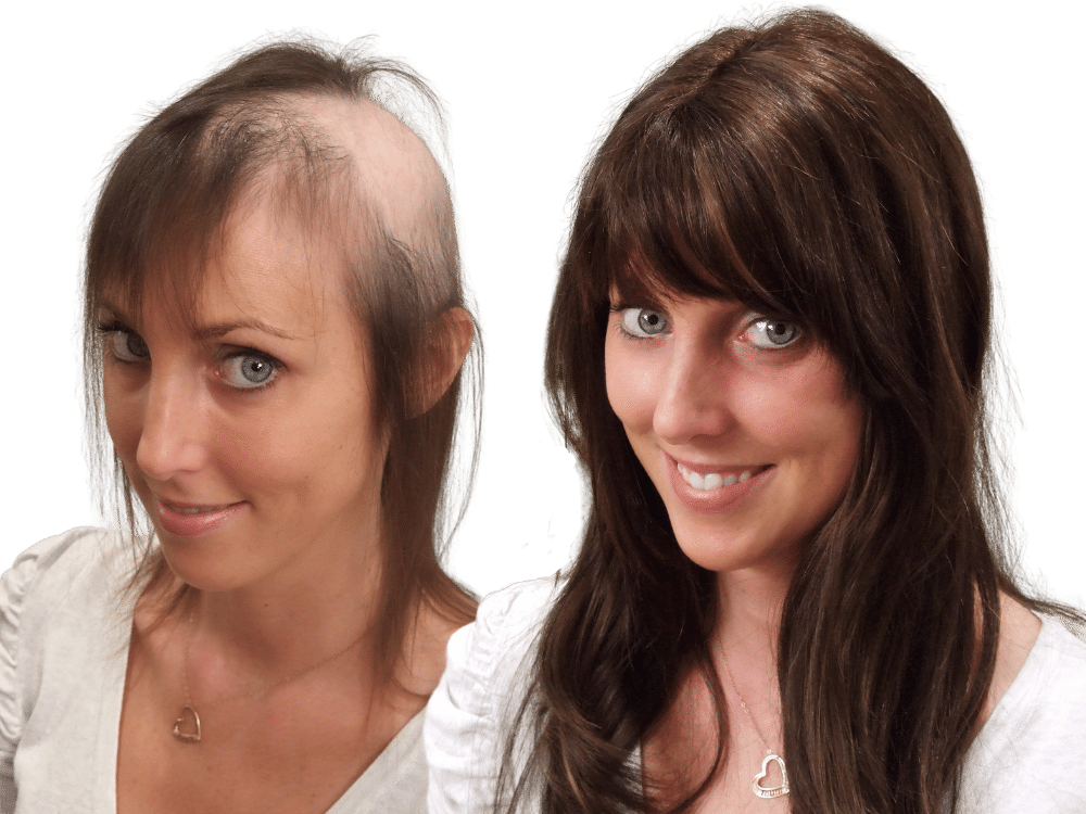 Mark Glenn Hair Extensions, London