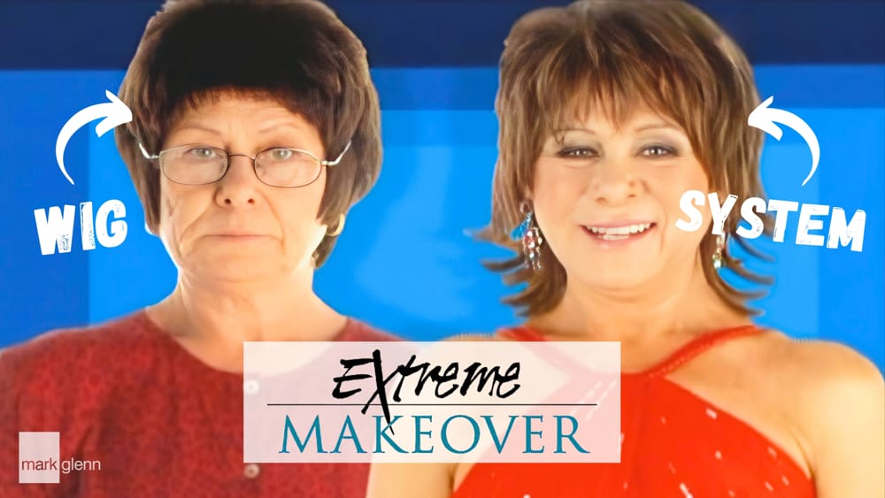 Androgenetic Alopecia Extreme Makeover TV - From Wig To Kinsey System