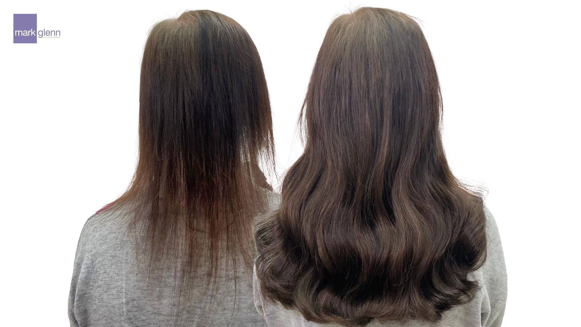 Trichotillomania Transformation With Mark Glenn Hair Extensions