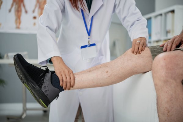 Arthrosamid knee injection