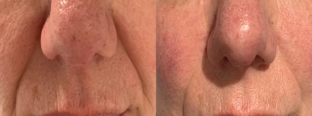 reproductive support