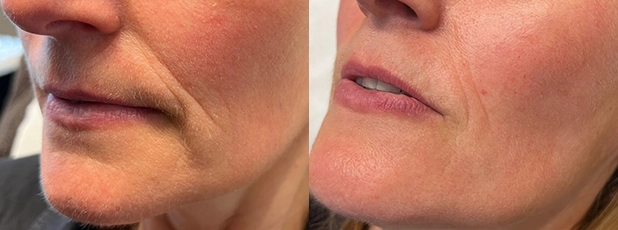 reproductive support