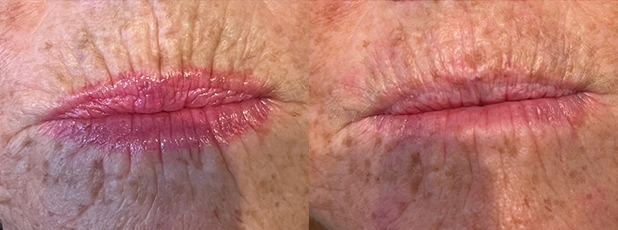 Menopause & Midlife Health