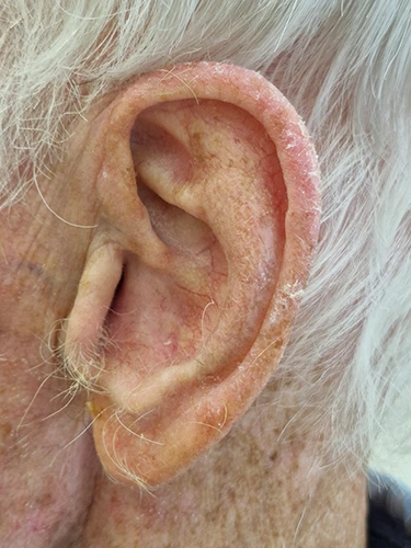 Importance of Ear Health